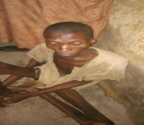He was found naked from the waist down and unable to walk without support